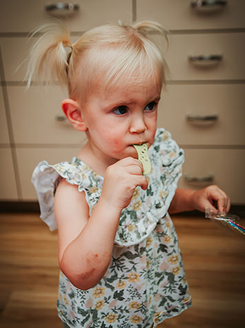 pediatric dental emergencies